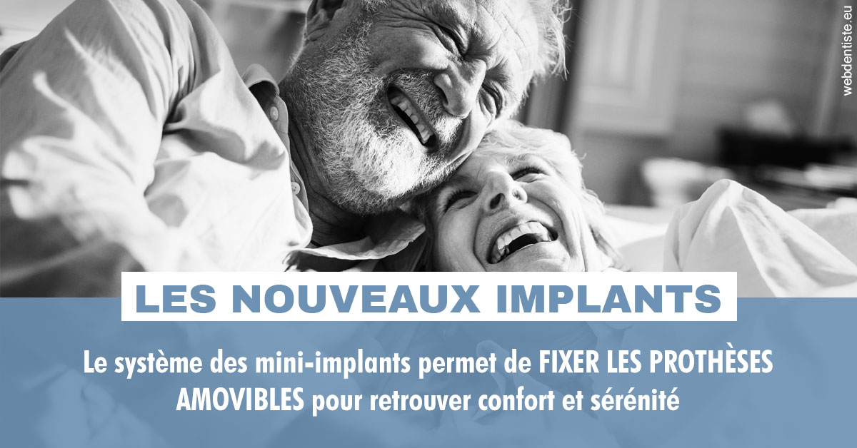 https://dr-touitou-yvan.chirurgiens-dentistes.fr/Les nouveaux implants 2
