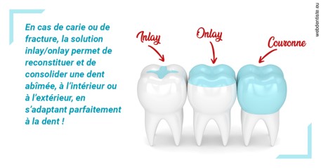 https://dr-touitou-yvan.chirurgiens-dentistes.fr/L'INLAY ou l'ONLAY