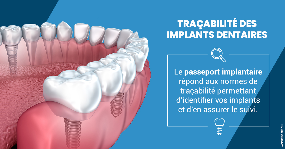 https://dr-touitou-yvan.chirurgiens-dentistes.fr/T2 2023 - Traçabilité des implants 1