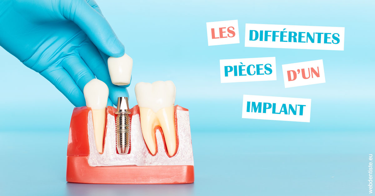 https://dr-touitou-yvan.chirurgiens-dentistes.fr/Les différentes pièces d’un implant 2