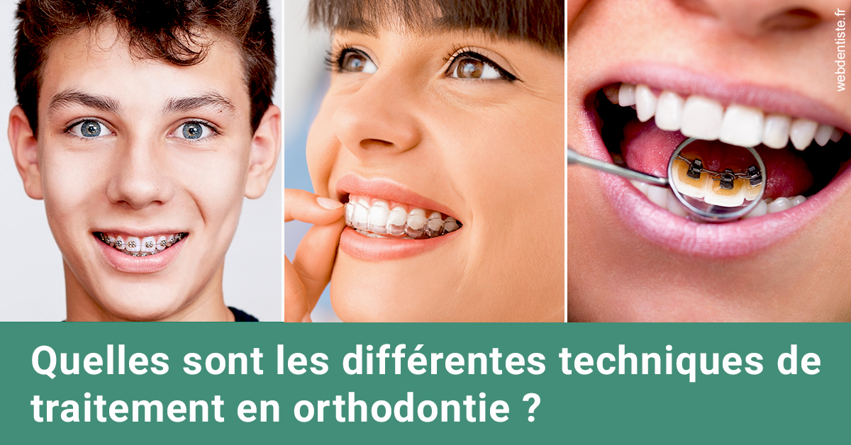 https://dr-touitou-yvan.chirurgiens-dentistes.fr/Les différentes techniques de traitement 2