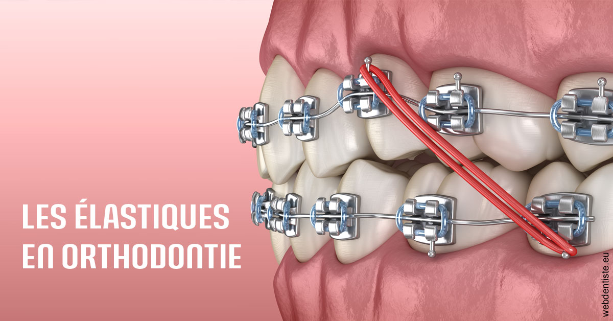 https://dr-touitou-yvan.chirurgiens-dentistes.fr/Elastiques orthodontie 2