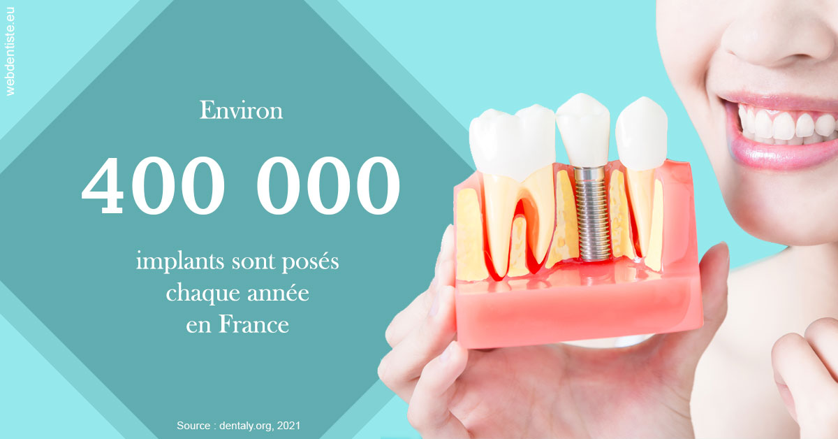 https://dr-touitou-yvan.chirurgiens-dentistes.fr/Pose d'implants en France 2